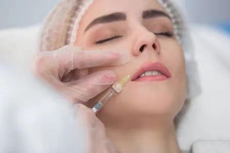 عبوة الحقنة حمض الهيالورونيك ضد التجاعيد ملء الأنف، هـ هـ حمض الهيالورونيك