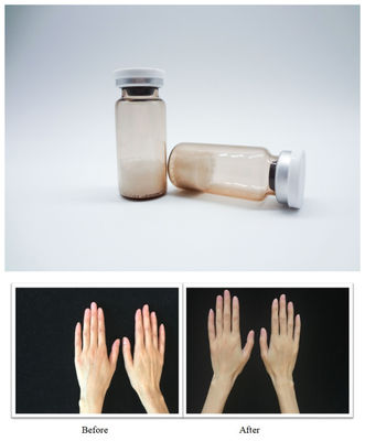 ملءات الجلد القابلة للعقمة للوجوه PLLA حمض الهيالورونيك جيل حقن مصمم لتصحيح التجاعيد السلسة واستعادة حجم الوجه